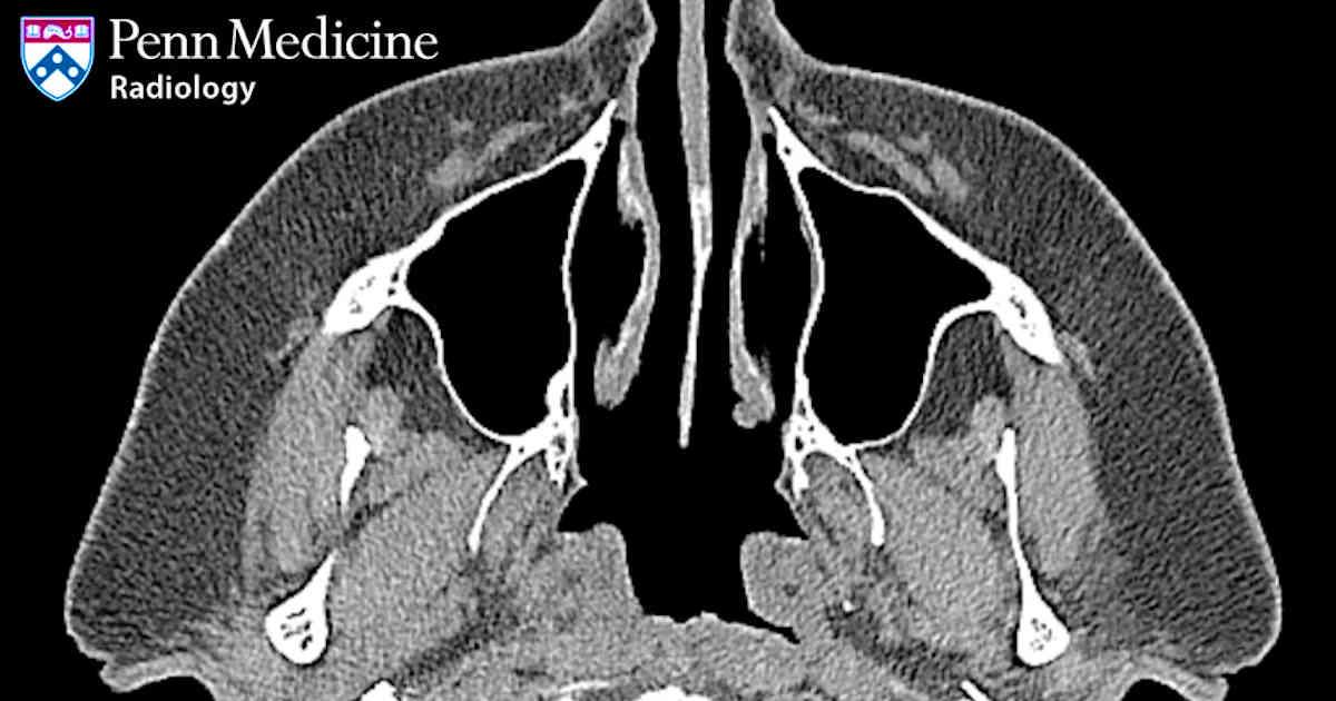 Radiology CME accredited by Voxmedia, LLC