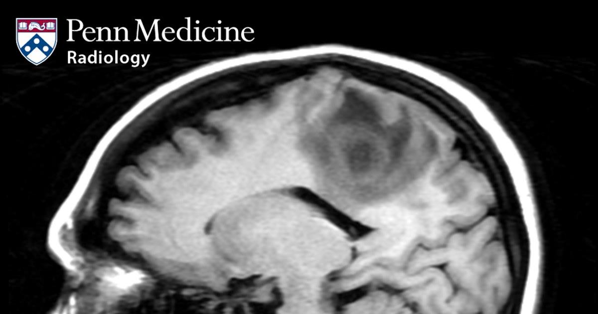 33-year-old-woman-with-weakness